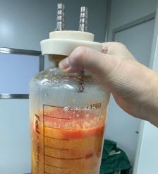 锦州水动力吸脂手术要做多久？
